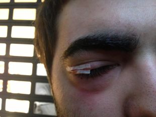 Dos manifestants ferits durant una protesta contra el príncep Felip