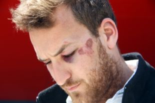 El jove de Cadaqués apallissat a Mestalla interposa una querella contra els agents de policia
