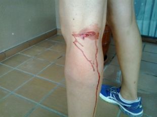 Dos gossos ataquen una dona mentre corria pel carril bici a Quart