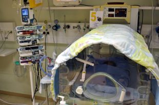 El Trueta aplica una nova tècnica per tractar asfíxies en nadons acabats de néixer
