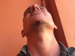 Ferit un home al accidentar-se amb una trampa per a ciclistes al massís de l'Ardenya