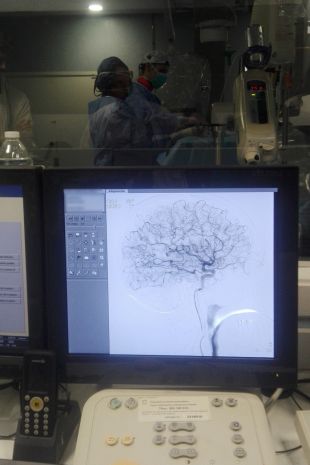 El Trueta fa 123 angiografies cerebrals el primer any d'implantació de la prova
