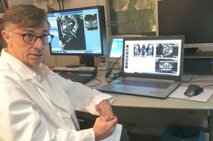 La Clínica Girona, pionera en incorporar un robot per millorar la diagnosi del càncer de pròstata