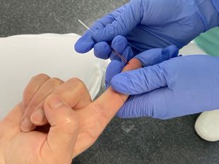 L'Hospital d'Olot suma dos nous casos de coronavirus i recupera deu professionals que estaven afectats 