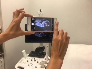 Les embarassades que es visiten a l'Hospital d'Olot podran registrar les imatges ecogràfiques durant els controls 