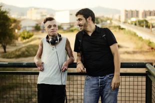 S'estrena un emotiu documental sobre un jove gironí amb el 91% del cos cremat