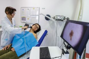 L'hospital Santa Caterina incorpora la dermatoscòpia digital per detectar i prevenir el càncer de pell