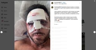 El pilot de l'avioneta estavellada a Viladamat és un polèmic influencer andorrà