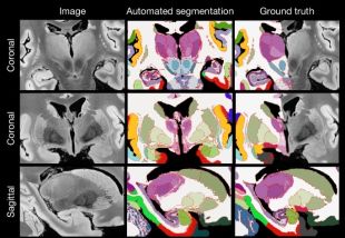 Un estudi liderat per un investigador de la UdG crea el mapa més complet del cervell humà