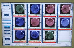 La Clínica Girona augmenta fins a un 10% l'èxit dels tractaments de fecundació in vitro