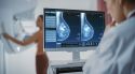 Investigadors catalans troben com reduir en un 48% la progressió d’un càncer de mama