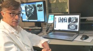 El doctor Joan Carles Vilanova de Clínica Girona durant la presentació del nou aparell robòtic