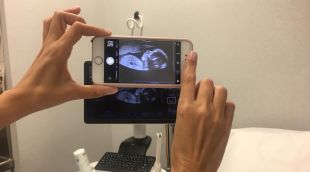 Una dona enregistrant una ecografia