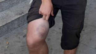 montserrat, agressió, mossos, princep