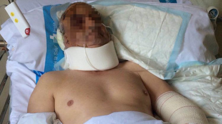 El veí de Llagostera ferit, encara a l'hospital Josep Trueta © ACN