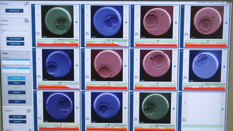 La Clínica Girona ja disposa d'un nou sistema innovador: l'EmbryoScope